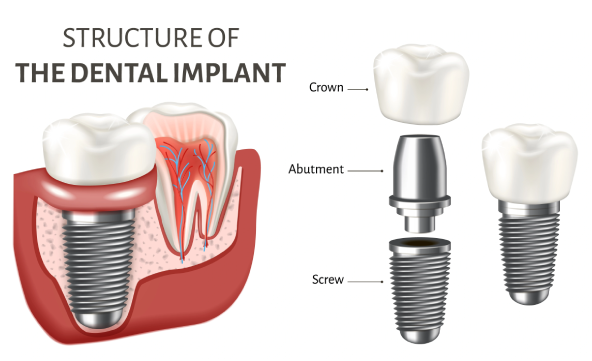 Initial Consultation